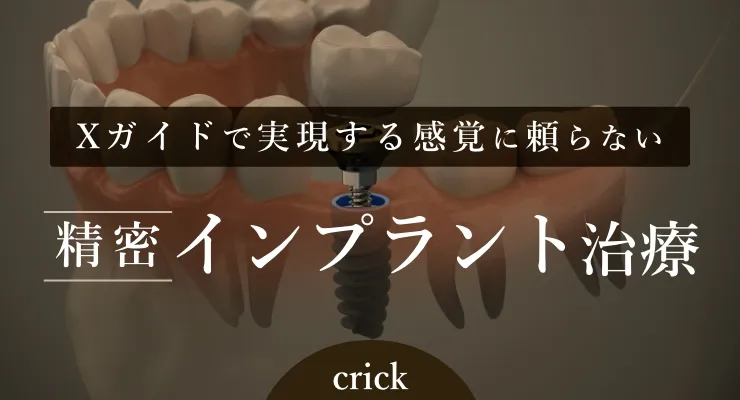 インプラント治療バナー